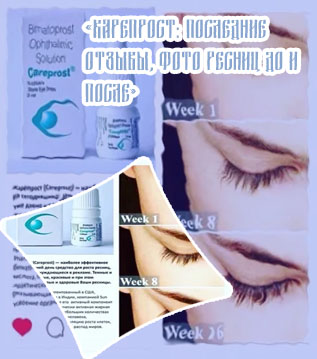 Карепрост для ресниц отзывы
